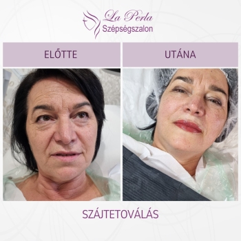 La Perla előtte utána - 2