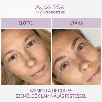 La Perla előtte utána - 1